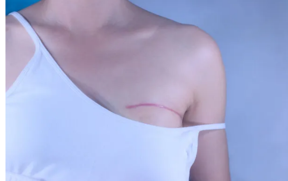 1-2312201HF5W7.png